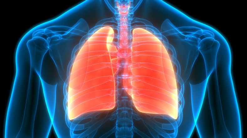 Rising Lung Cancer Cases in Nonsmokers Linked to Environmental and Genetic Factors