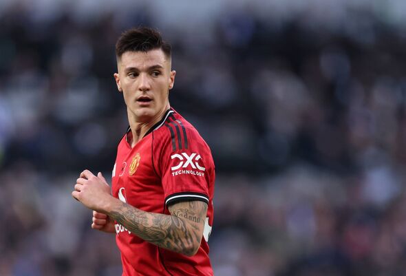 Injured Sesko to Miss Slovenia Games but United Hopeful of Quick Return